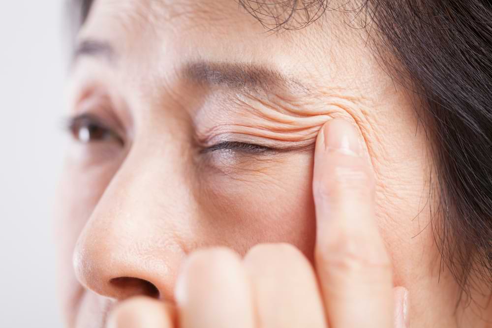 sjogren dry eye syndrome